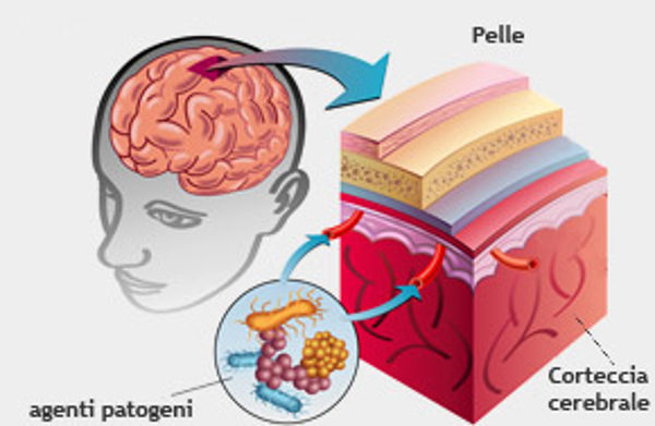 sintomi cura diagnosi prevenzione meningite
