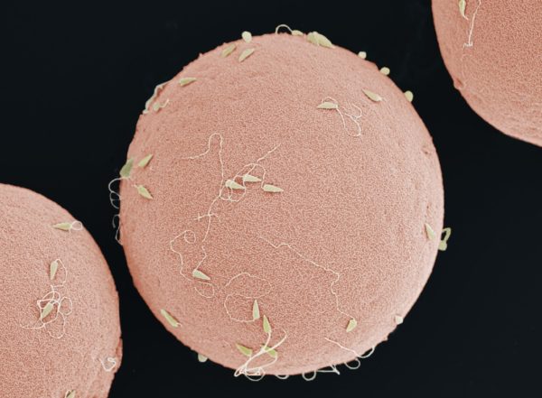 immagine-al-microscopio-elettronico-a-scansione-di-spermatozoi-sullasuperficie-di-un-uovo-di-riccio-di-mare-non-fecondato