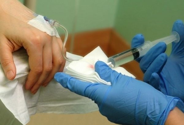 chemioterapia lavaggio drenaggio tumore