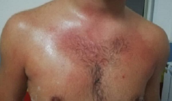 calciatore aggredito