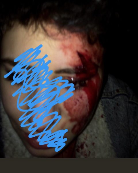 ludovica aggredita capodanno