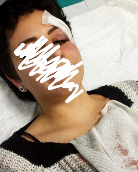 ludovica aggredita capodanno