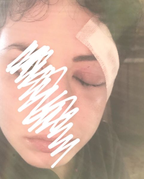 ludovica aggredita capodanno