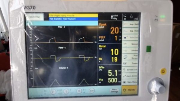 ventilatori ospedale