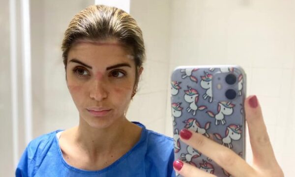 martina infermiera cardarelli