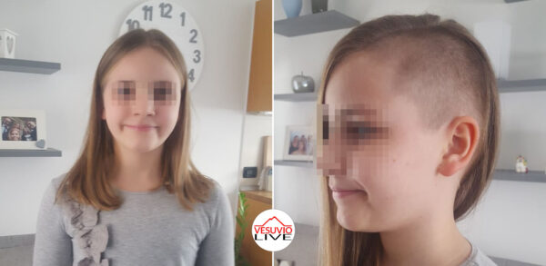 allegra capelli rasati parrucca