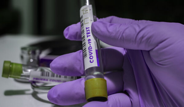 covid italia 10 aprile