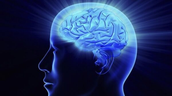 cervello ictus cerebrale