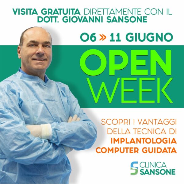 open week dottor giovanni sansone implantologia computer guidata open week dottor giovanni sansone implantologia computer guidata