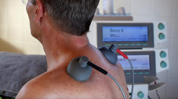 neurostimolatore midollare