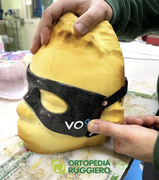 Ortopedia Ruggiero, prodotta una nuova maschera per Victor Osimhen