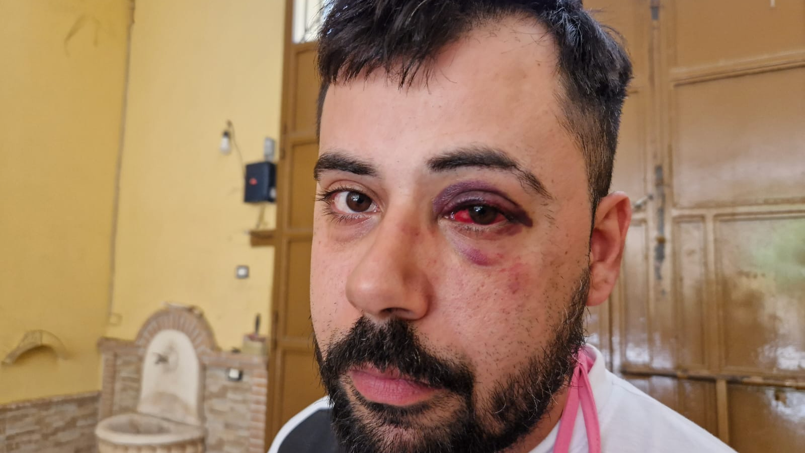 Enrico picchiato parcheggiatore abusivo Marechiaro