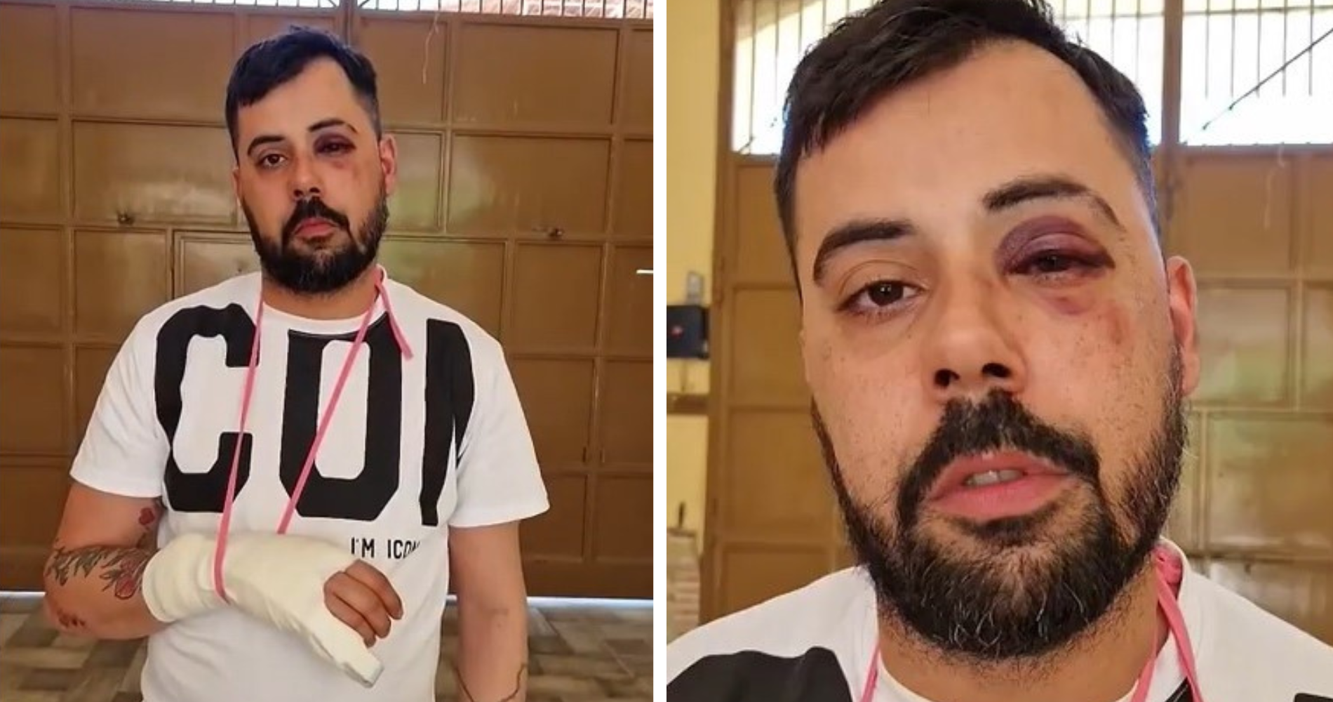 picchiato parcheggiatore abusivo marechiaro