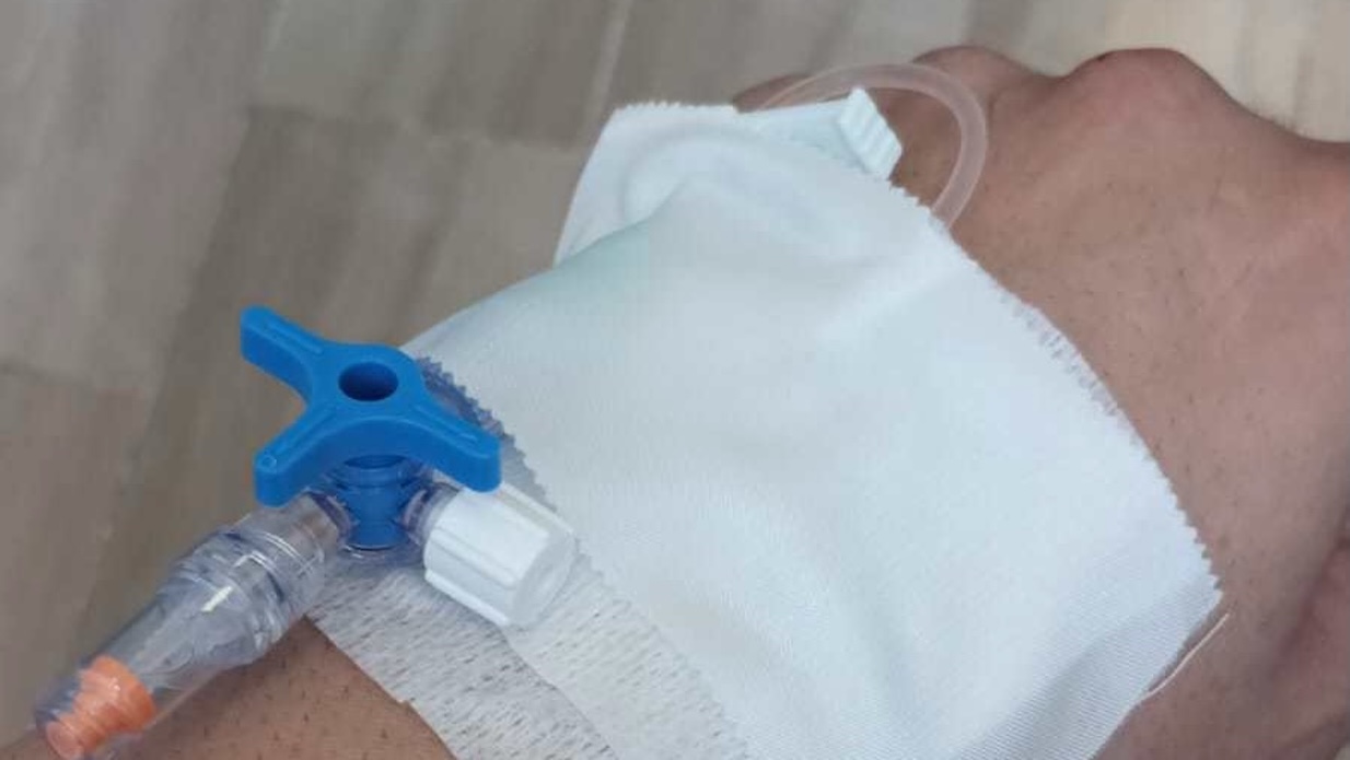 Il calvario di Enrico, pestato brutalmente da un parcheggiatore abusivo: amputata la falange