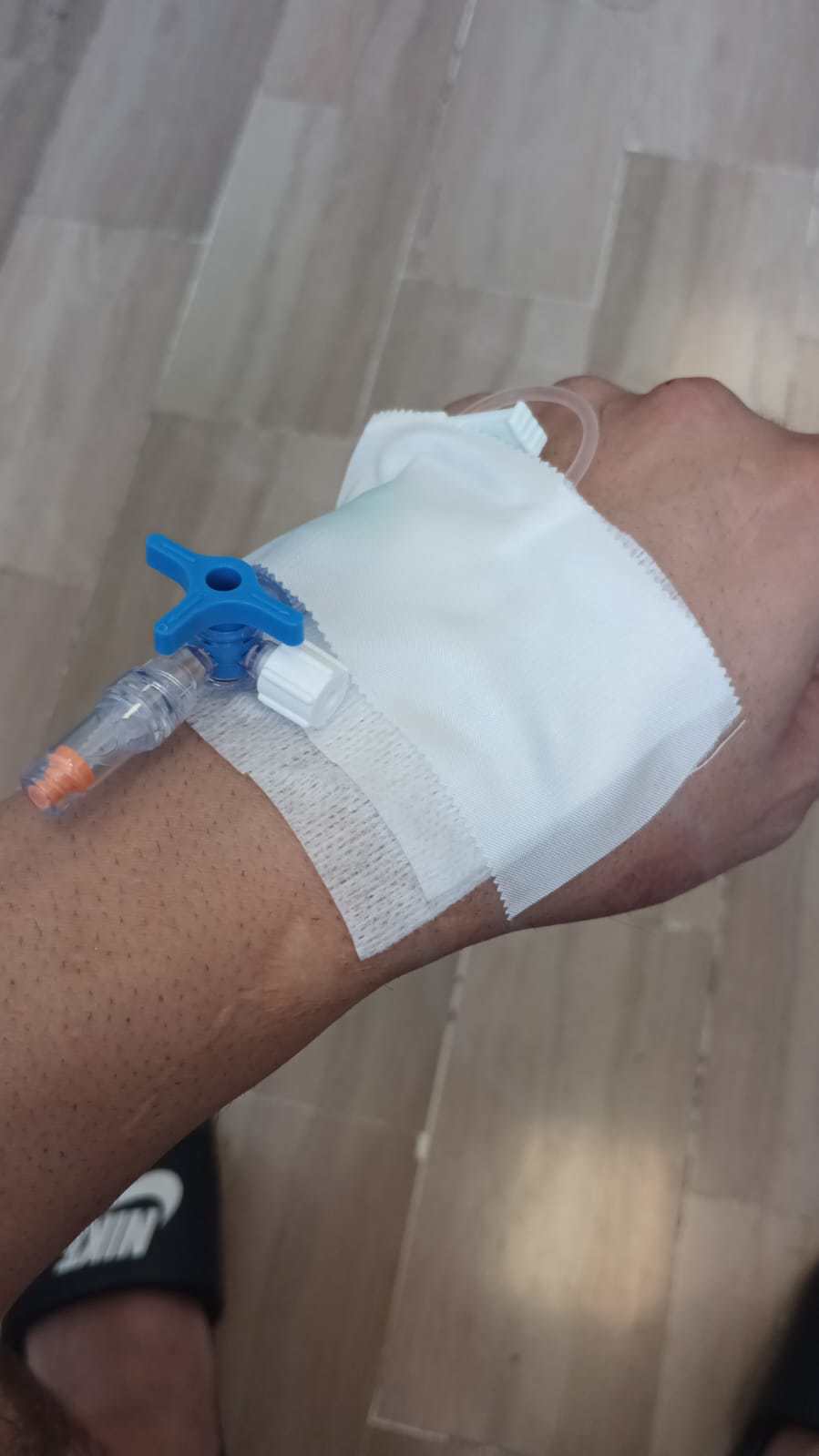 La mano della vittima del violento pestaggio a Marechiaro da parte di un parcheggiatore abusivo